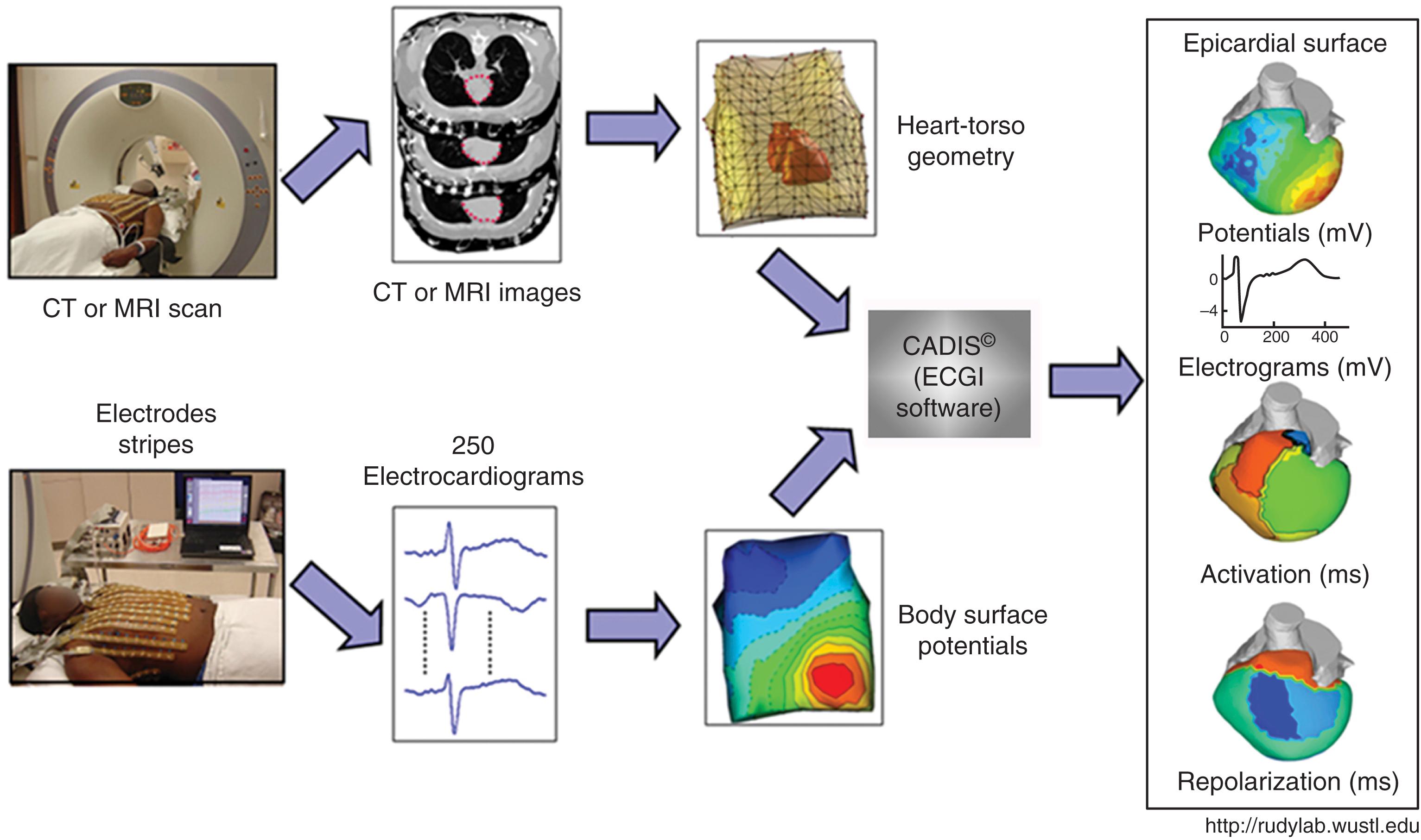 EFIGURE 61.5, Noninvasive electrophysiologic mapping using ECGI. Body surface potentials are recorded from 256 electrodes. Thoracic CT or MRI scan is used to generate a patient-specific heart and torso geometry. The data are integrated to reconstruct epicardial potentials and unipolar electrograms on the heart surface. Epicardial activation and recovery can be further derived from the electrograms.