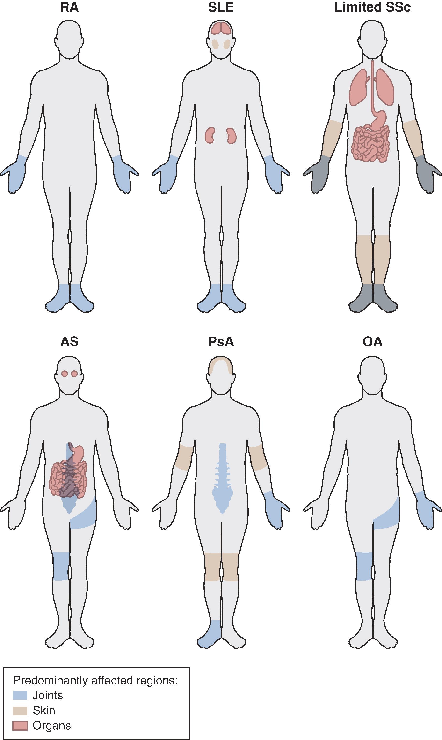 FIGURE 236-1, Patterns of joint and organ involvement in rheumatic disease.