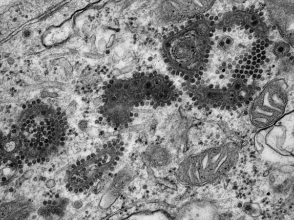 Figure 7-13, Thin section EM image of EEE virus in mouse brain. Nucleoids are seen within the cytoplasmic matrix and upon complex membranous structures.