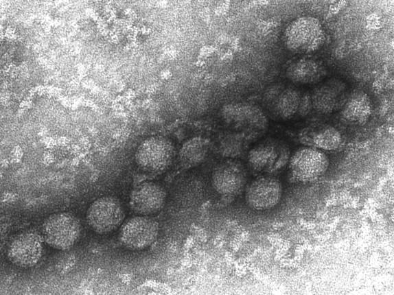 Figure 7-19, Negative stain EM image of a cell culture isolate of WNV, with spherical virus particles averaging 45 nm in diameter.