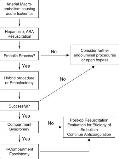 FIGURE 1, Algorithm of treatment for acute limb ischemia and catheter embolectomy. ASA, Aspirin; OR, operating room; Post-op, postoperative.