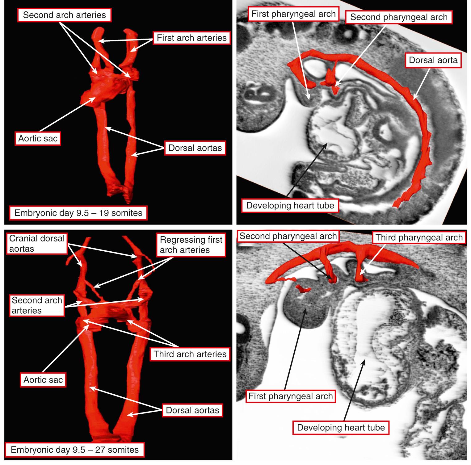 Fig. 48.2, Reconstructed episcopic datasets from developing mice sacrificed during embryonic day 9.5. The upper panels are from a mouse with 19 somites, whereas the mouse providing the material for the lower panels had 27 somites. The arterial channels running from the aortic sac to the dorsal aortas have been reconstructed in the panels at left, whereas the panels at right show the relationship of the arterial channels to the pharyngeal mesenchyme.