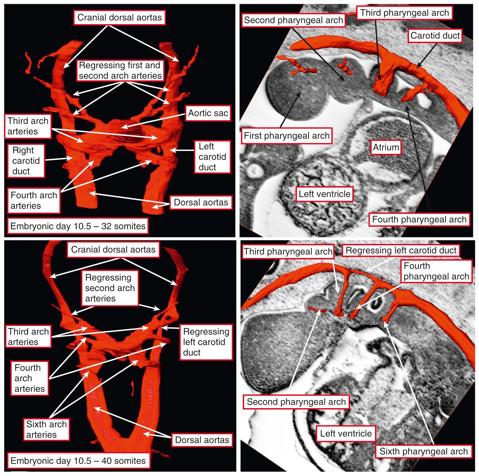 Fig. 48.3, Reconstructed episcopic datasets from developing mice sacrificed during embryonic day 10.5 showing the ongoing development of the arch arteries concomitant with regression of the arches formed in the first and second arches. Note that the dorsal aortas continue cranially as the carotid ducts. The images shown in the upper panels are from an embryo with 32 somites, whereas the embryo from which the lower panels were prepared had 40 somites.