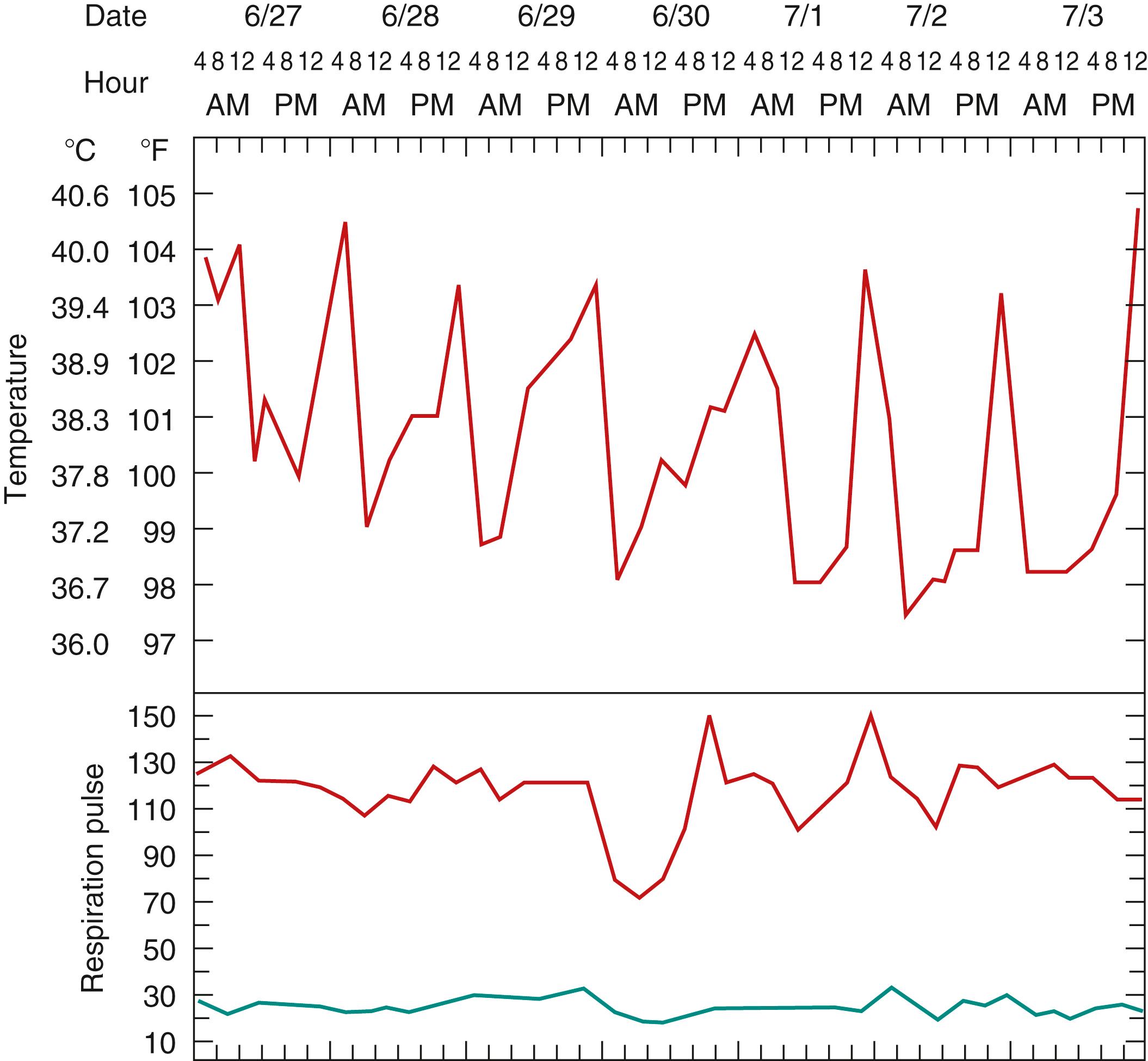 Fig. 44.3, Intermittent fever of systemic-onset juvenile idiopathic arthritis in a 3-year-old girl.