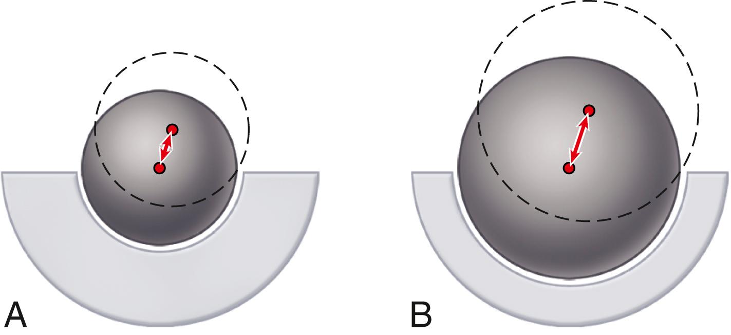 FIGURE 3.12, Jump distance. With subluxation, smaller head ( A ) has shorter distance to travel before escaping rim of acetabular component than larger one ( B ).