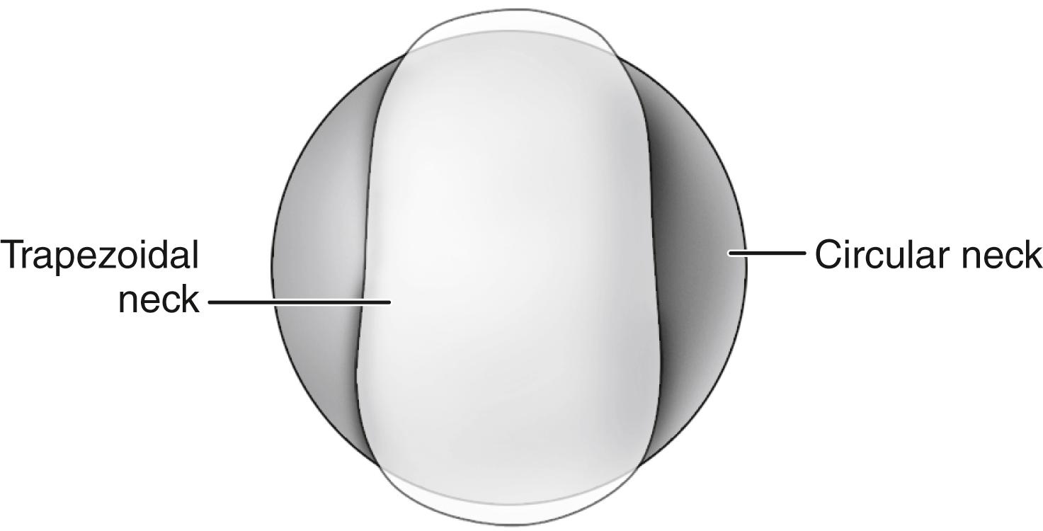 FIGURE 3.14, Cross-sectional comparison of circular and trapezoidal neck.