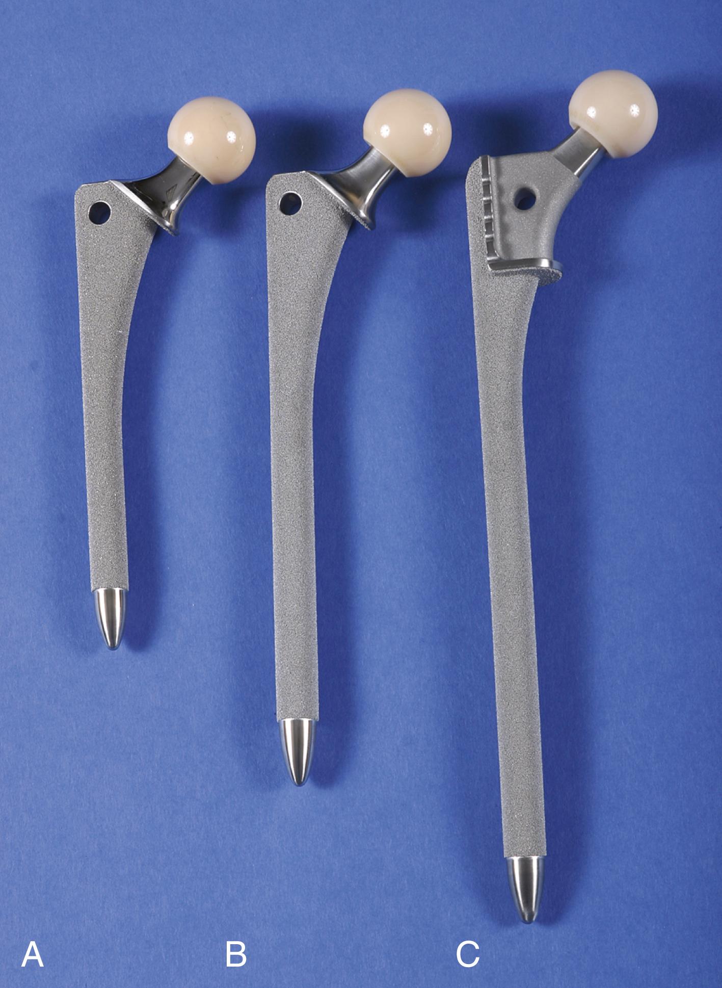 FIGURE 3.25, Extensively porous-coated stems. A, Anatomic medullary locking (AML) stem for primary and revision arthroplasties when isthmus is intact. B, Extensively coated solution long stem used for revisions when proximal bone loss is severe. C, Calcar replacement long stem.