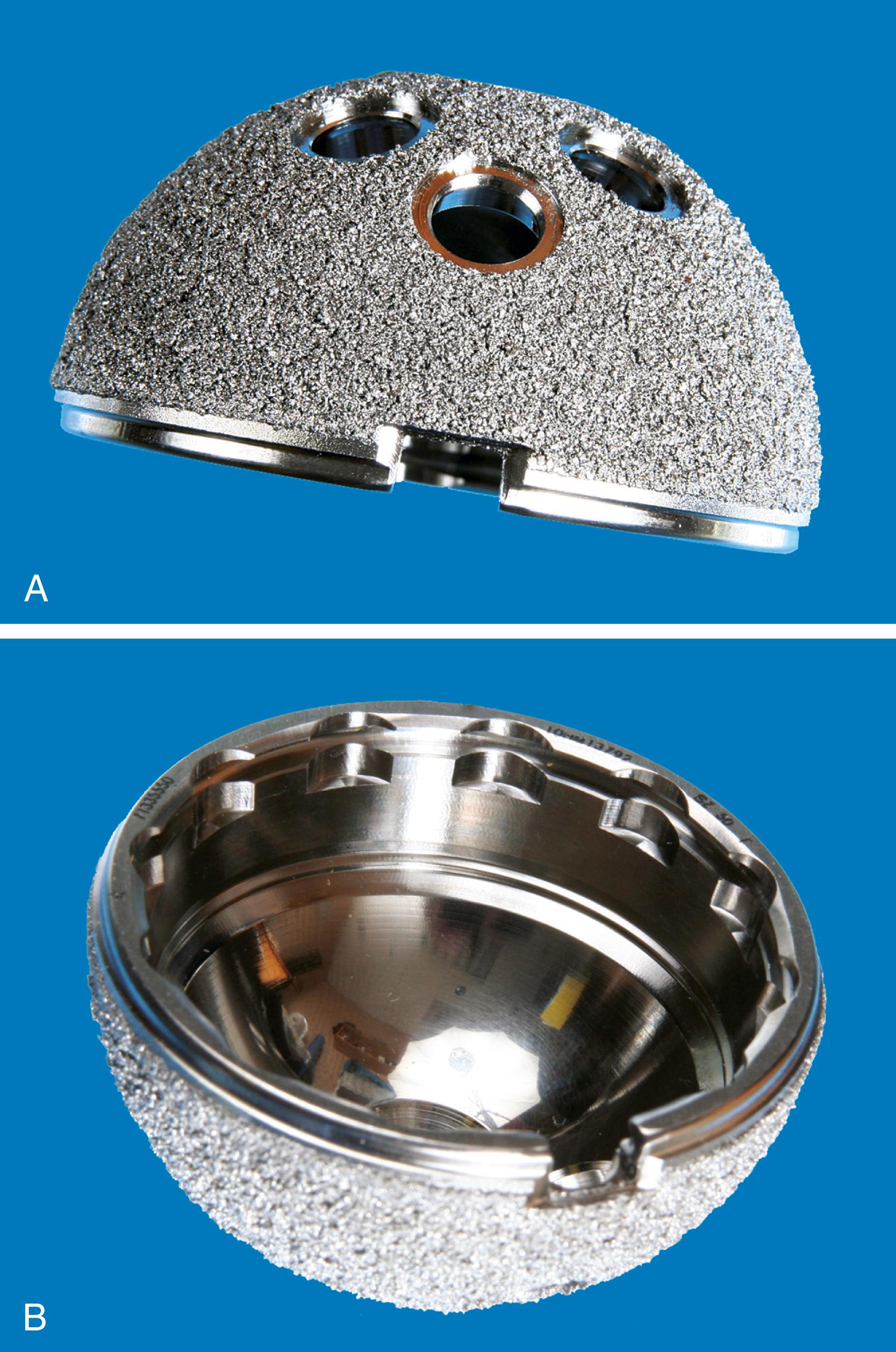 FIGURE 3.32, R3 acetabular component. A, Hemispherical shell with optional screw fixation and highly porous titanium coating. B, Locking mechanism is recessed to avoid thin polyethylene at rim and accept various bearing inserts.