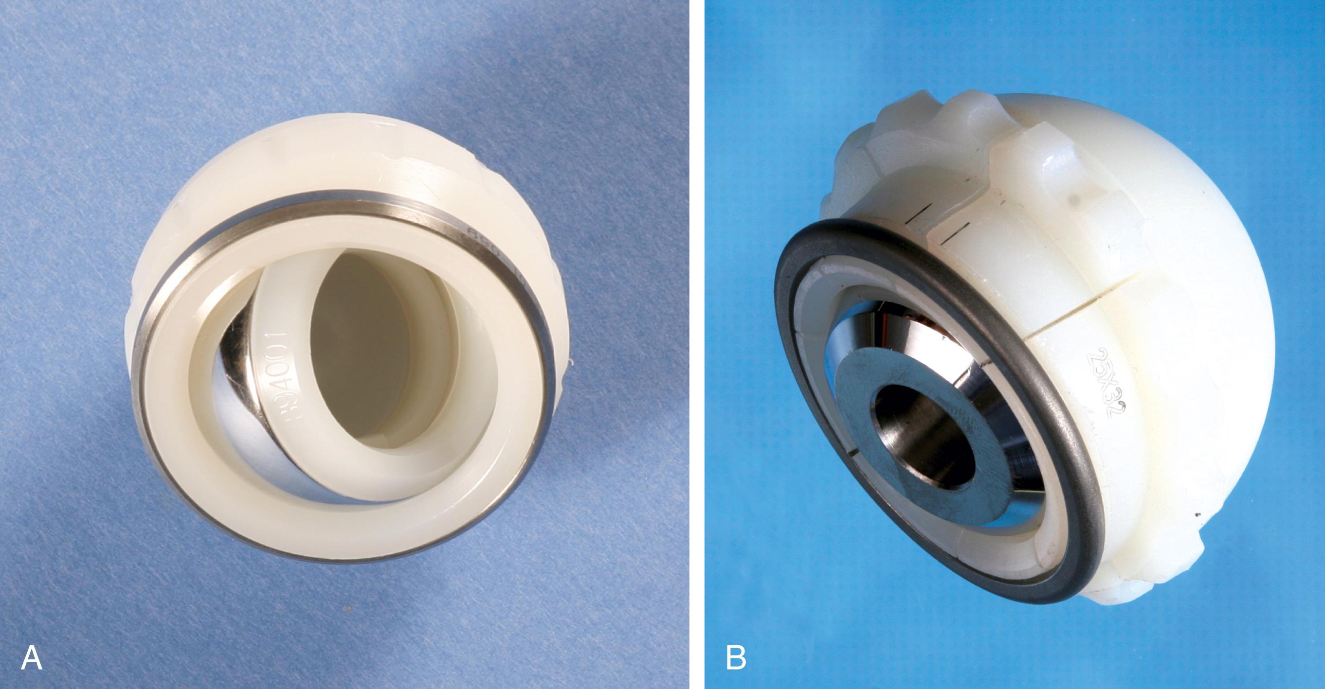 FIGURE 3.34, A, Tripolar design with small bipolar shell captured within outer liner. B, Peripheral locking ring design.