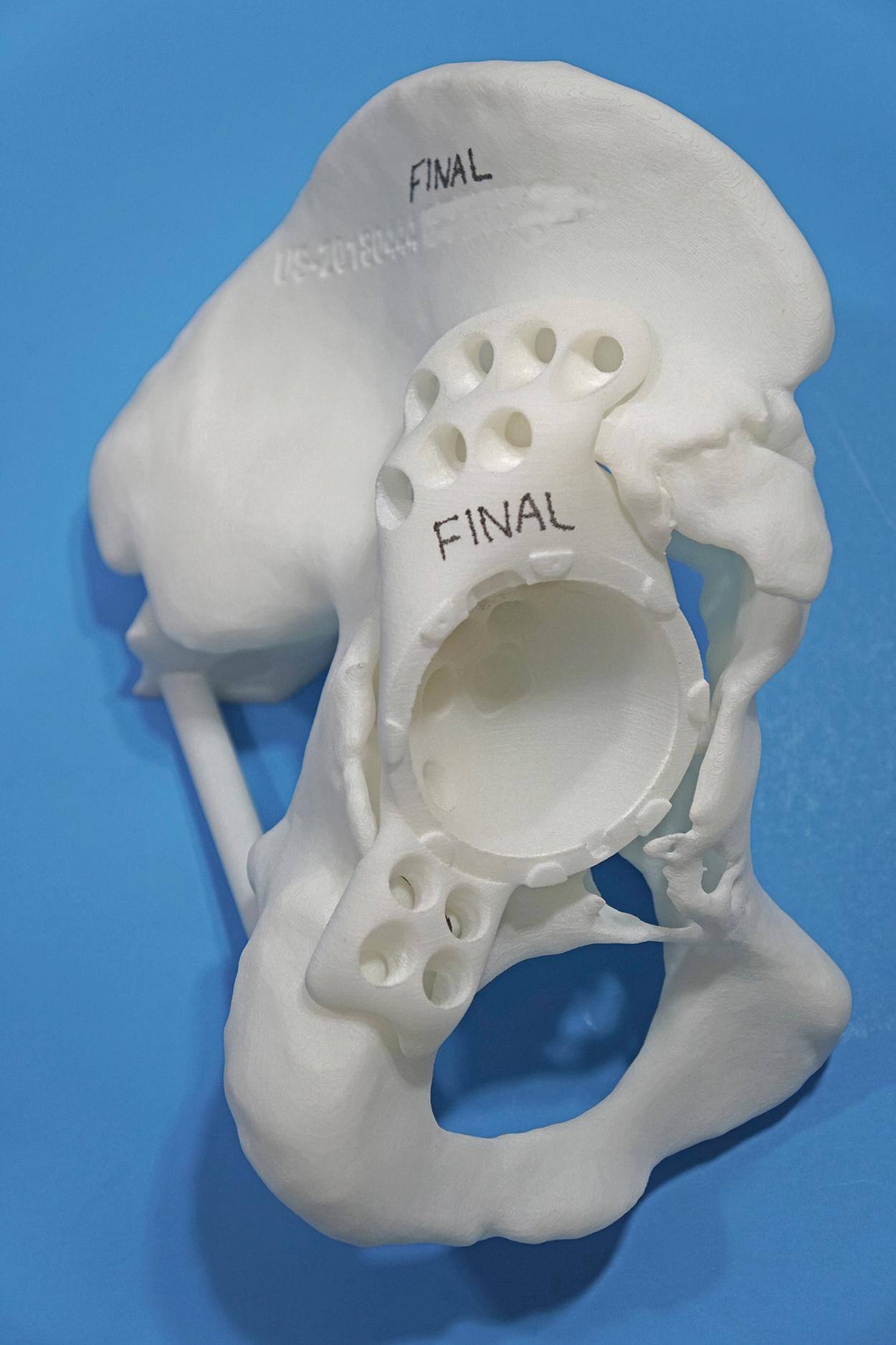 FIGURE 3.37, Implant trial and bone model can be sterilized for reference in surgery.