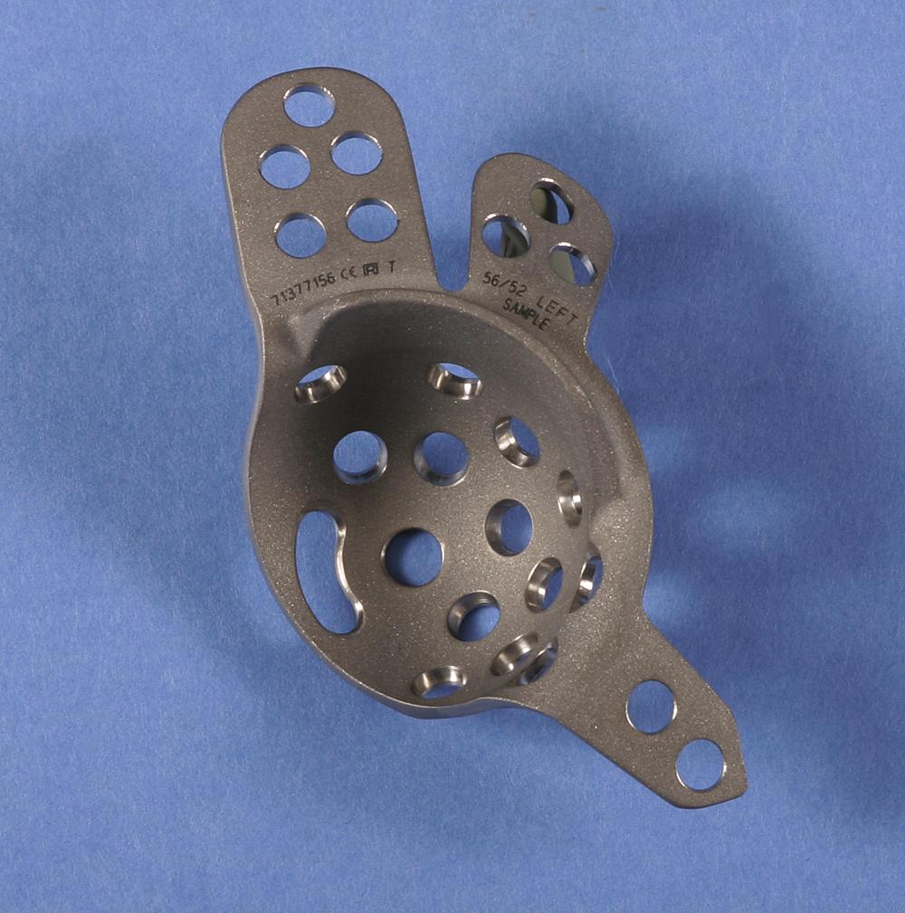 FIGURE 3.38, Contour antiprotrusio cage has titanium support ring fixed to ilium and ischium with screws. Alternatively, inferior fin can be impacted into ischium without screws.