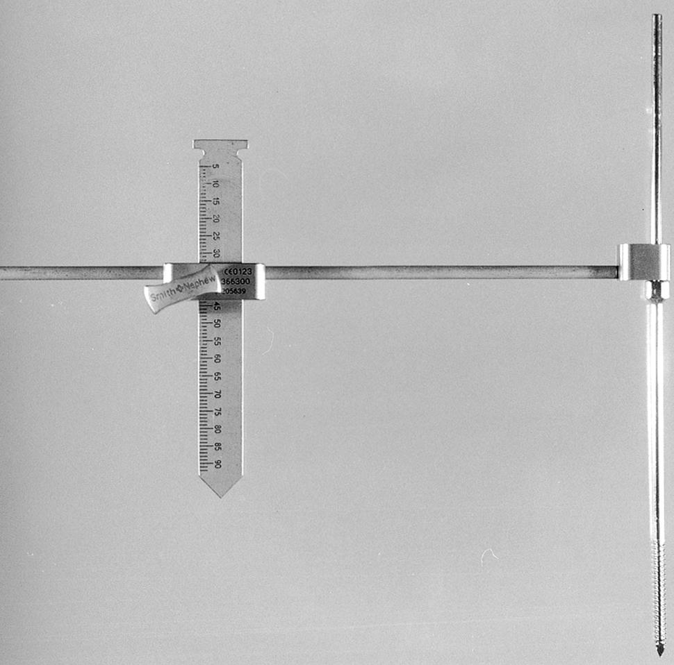 FIGURE 3.44, Device for intraoperative leg-length measurement. Sharp pin is placed in pelvis above acetabulum or iliac crest, and measurements are made at fixed point on greater trochanter. Adjustable outrigger is calibrated for measurement of leg length and femoral offset. SEE TECHNIQUE 3.2.