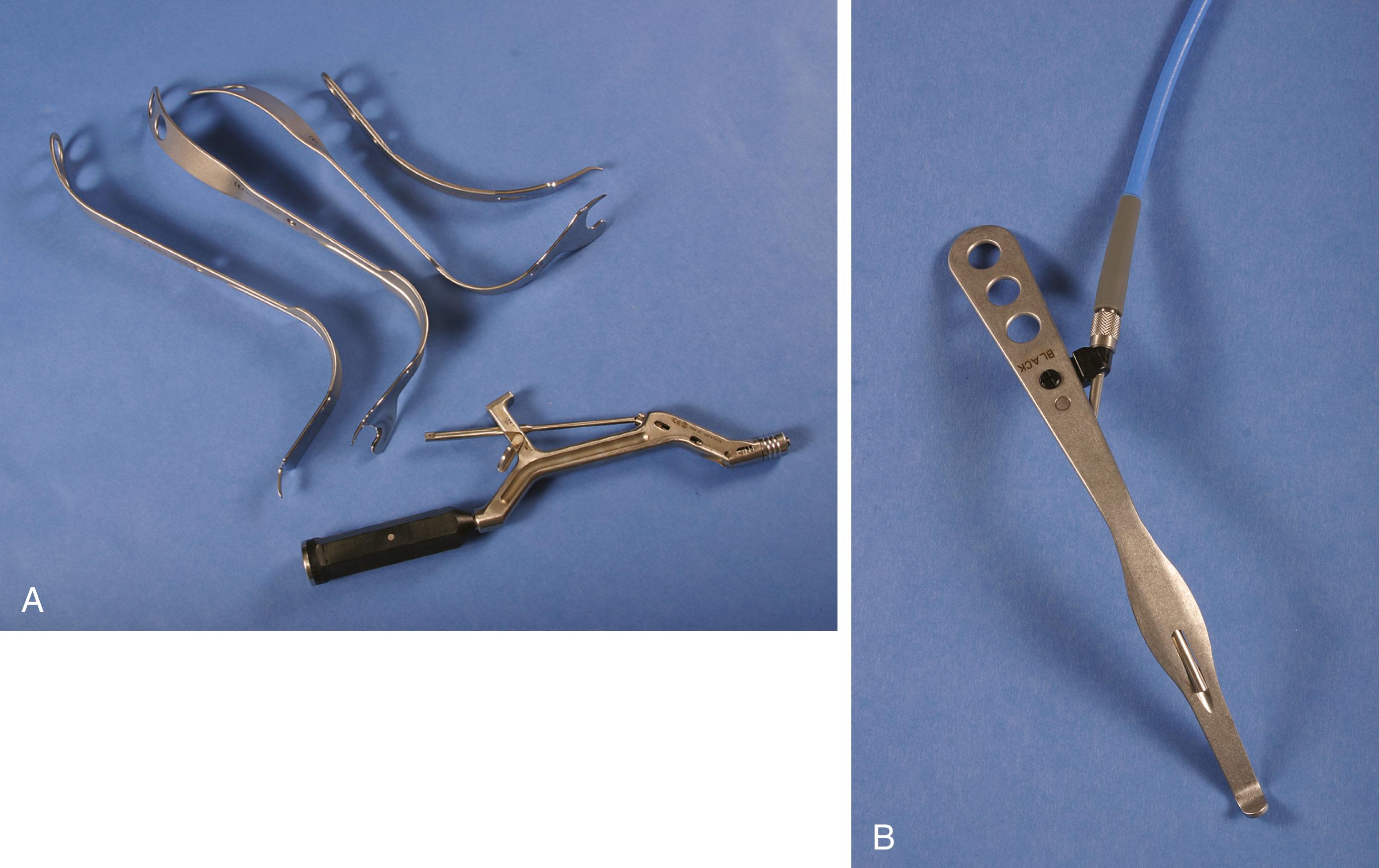 FIGURE 3.69, A and B, Array of retractors with long handles, angulated acetabular insertion device, and fiberoptic lighting (B) for minimally invasive hip surgery.