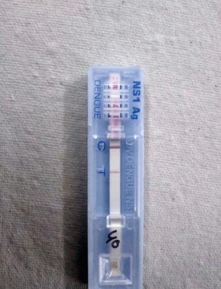 Fig. 1.23, Dengue point-of-care test.