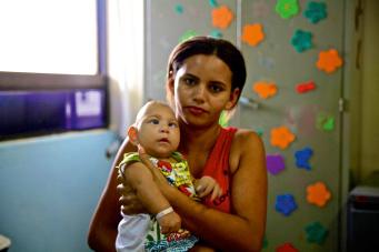 Fig. 1.35, Brazilian infant with microcephaly.