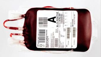 Fig. 1.44, Blood transfusion.