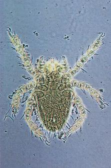 Fig. 1.72, Larva of Leptotrombidium .