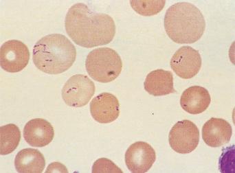 Fig. 1.77, Blood film showing Bartonella bacilliformis in Carrión’s disease.