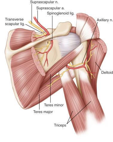 FIG. 52.2, The suprascapular nerve passes through the scapular notch below the transverse scapular ligament. The suprascapular artery and vein pass above the ligament. The suprascapular nerve continues down around scapular spine and through the spinoglenoid notch, where the nerve is relatively constrained by the inferior transverse scapular ligament.