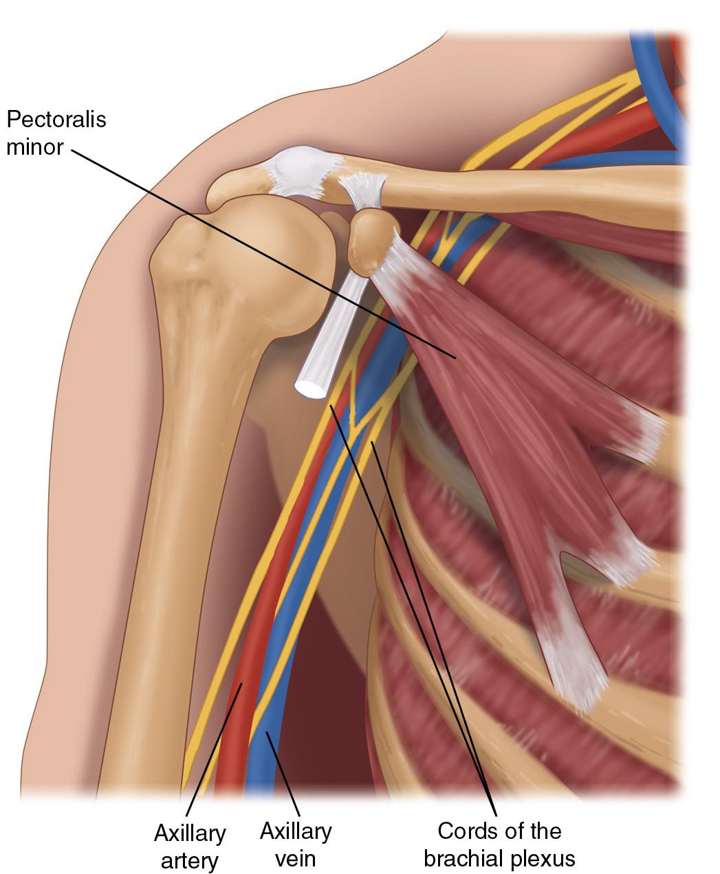 Fig. 40.1, Pectoralis minor space, containing the cords of the brachial plexus, axillary artery, and axillary vein.