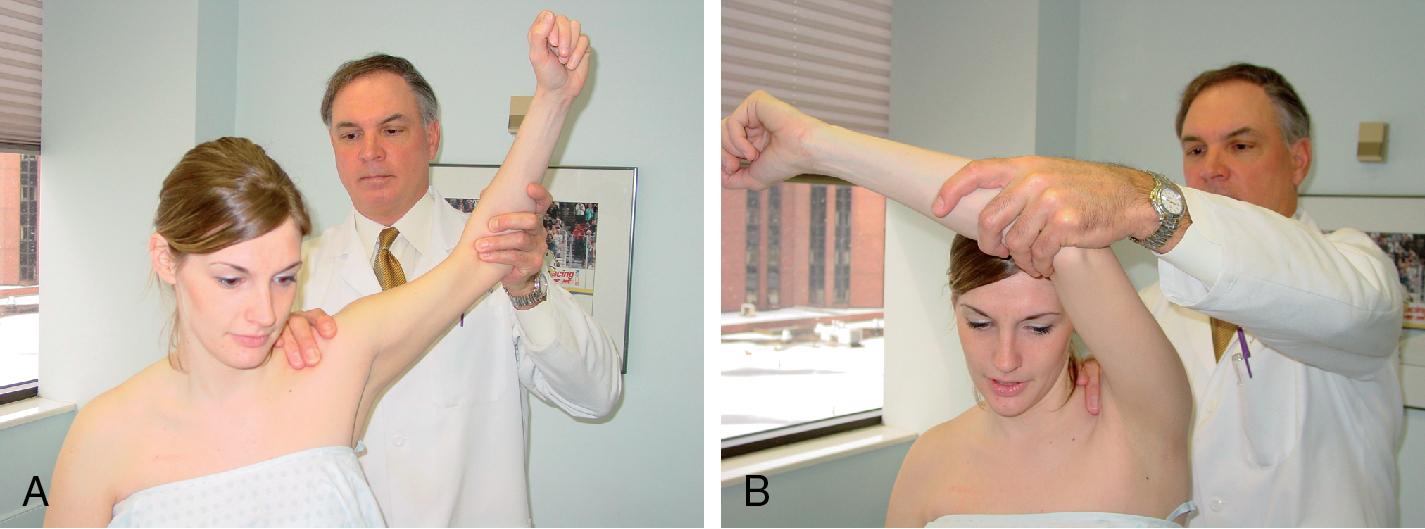 Fig. 9.4, The Kim test for the detection of posteroinferior labral lesions is performed by applying axial compression to the 90-degree abducted arm (A), which is then elevated and forward flexed in a diagonal direction (B), resulting in pain and a possible clunk.