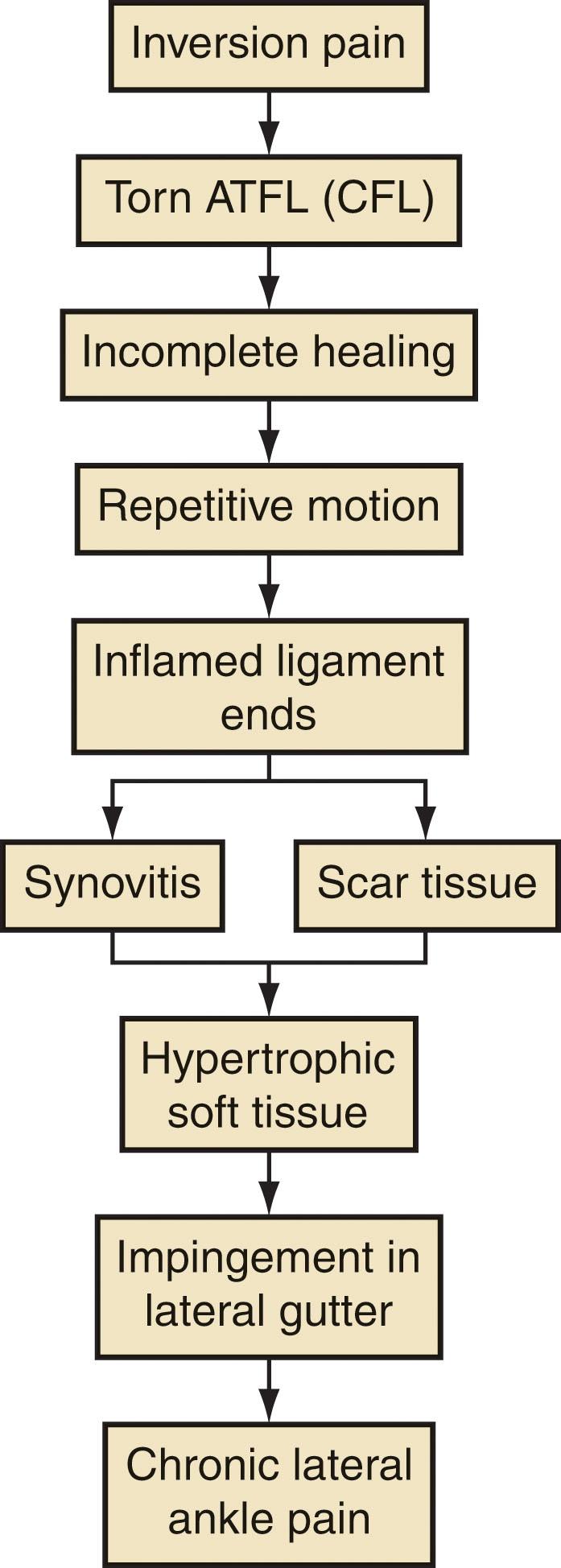 Fig. 39-24, Sequence of lateral ankle pain. ATFL , Anterior talofibular ligament; CFL , calcaneofibular ligament.