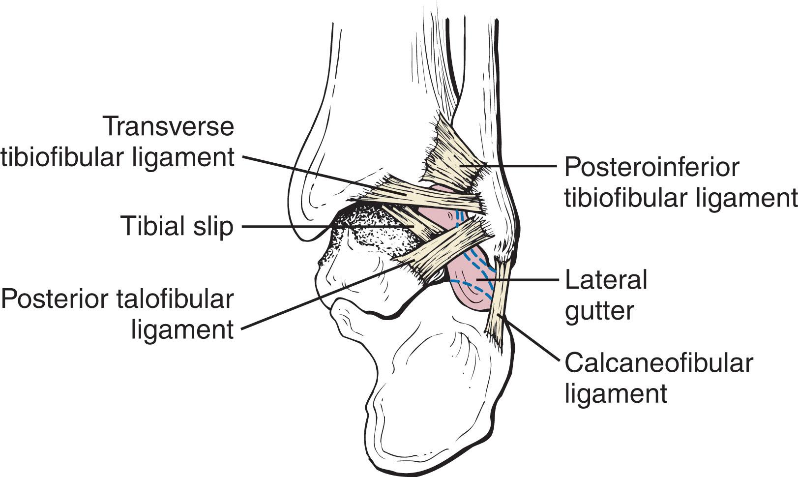 Fig. 39-27, Posterior anatomy of the lateral gutter. Note that the tibial slip runs between the transverse tibiofibular ligament and posterior talofibular ligament.