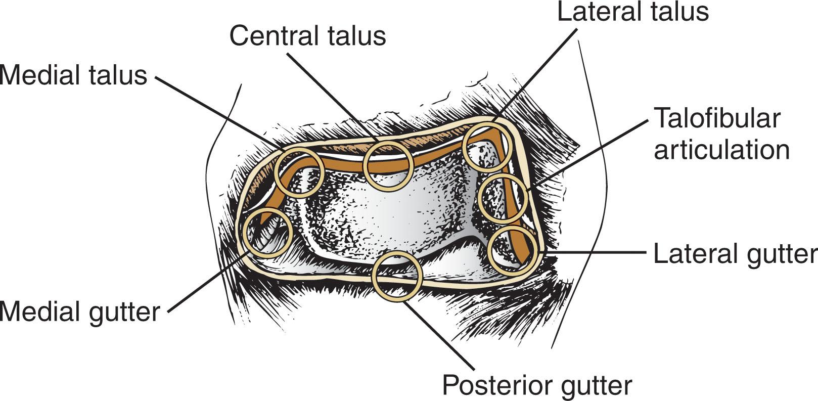 Fig. 39-10, Seven-point posterior ankle examination through the arthroscope.