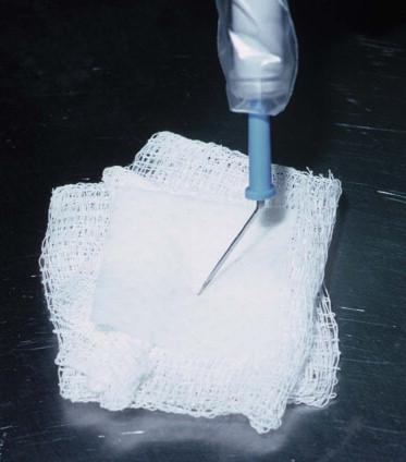 FIGURE 2.2, The same type of alcohol pad as used in Figure 2.1 but allowed to dry. It does not ignite despite prolonged contact with the electrocautery tip and maximum settings.