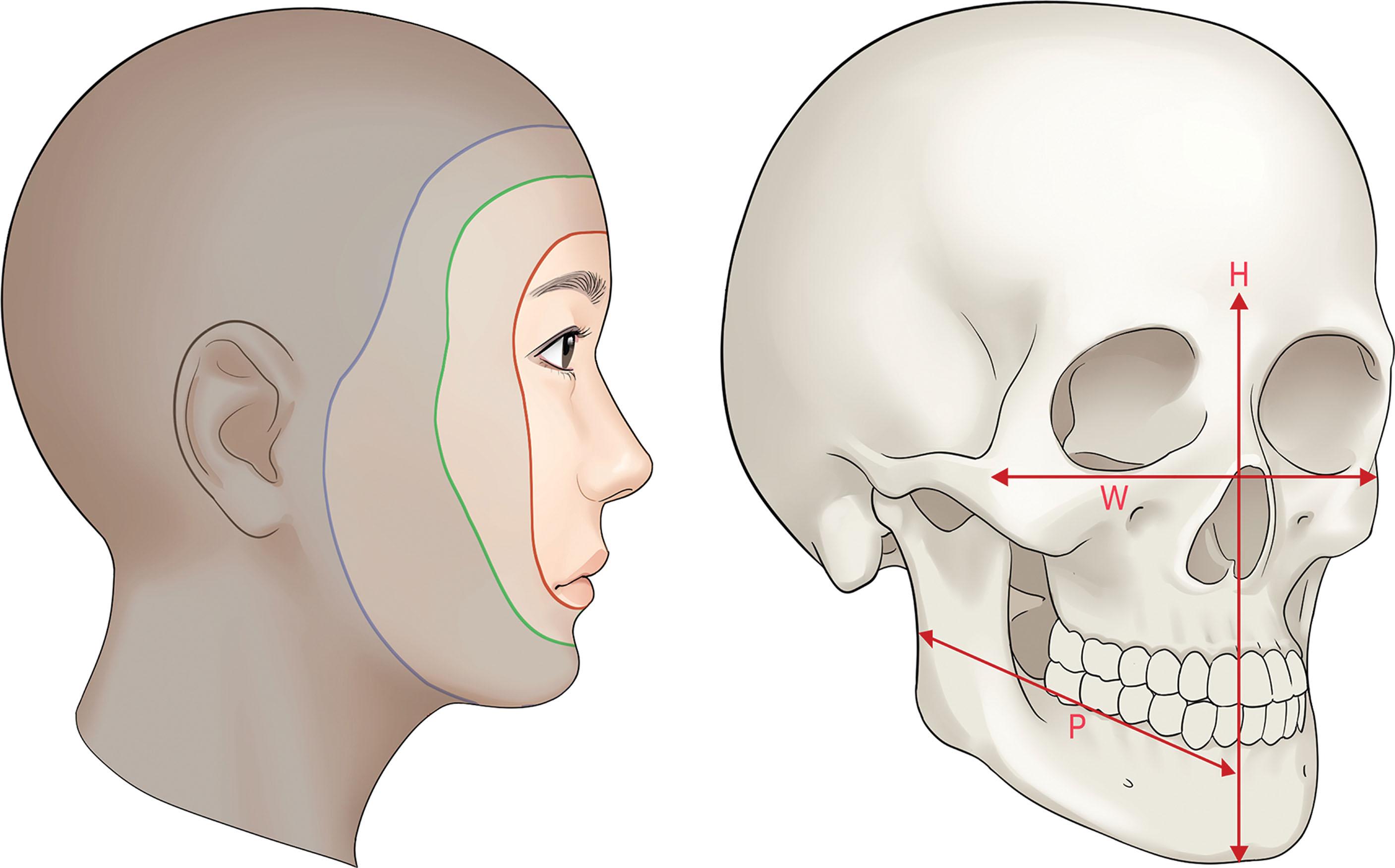 Figure 15.1, Multiple facial contours based on the facial depth level. The facial planes are changed according to the patient’s facial width, height, and projection.