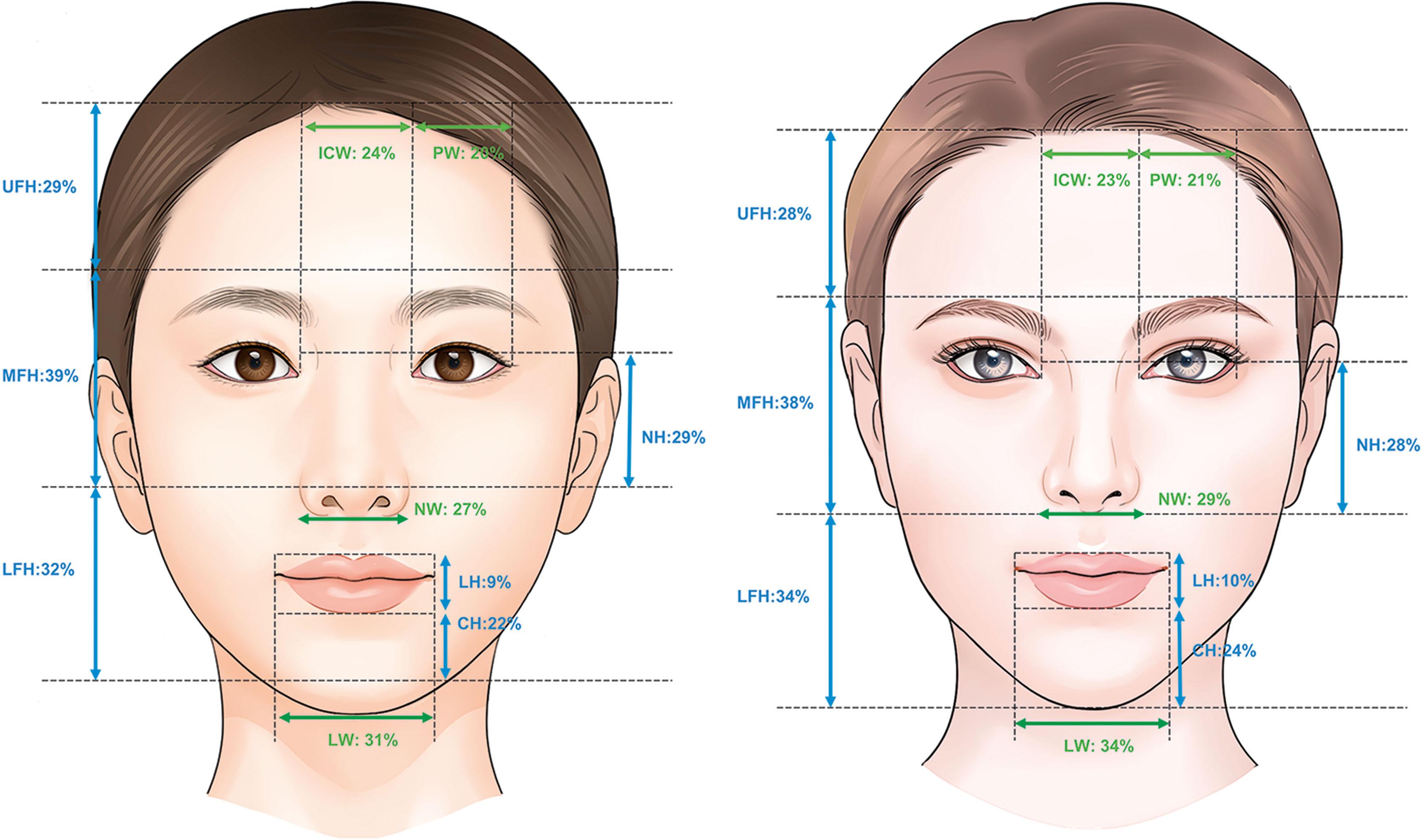 Figure 15.3, Ideal facial proportions in attractive Asian and Western women. CH , Chin height; ICW , intercanthal width; LFH , lower facial height; LH , labial height; LW , labial width; MFH , middle facial height; NH , nasal height; NW , nasal width; PW , palpebral width; UFH , upper facial height.