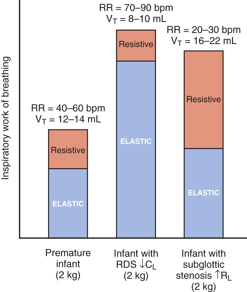 Fig. 63.1, Relative contributions of the elastic and resistive components of the work of breathing in infants with normal pulmonary function, decreased lung compliance (C L ), and increased lung resistance (R L ). RDS, Respiratory distress syndrome; RR, respiratory rate; V T , tidal volume.