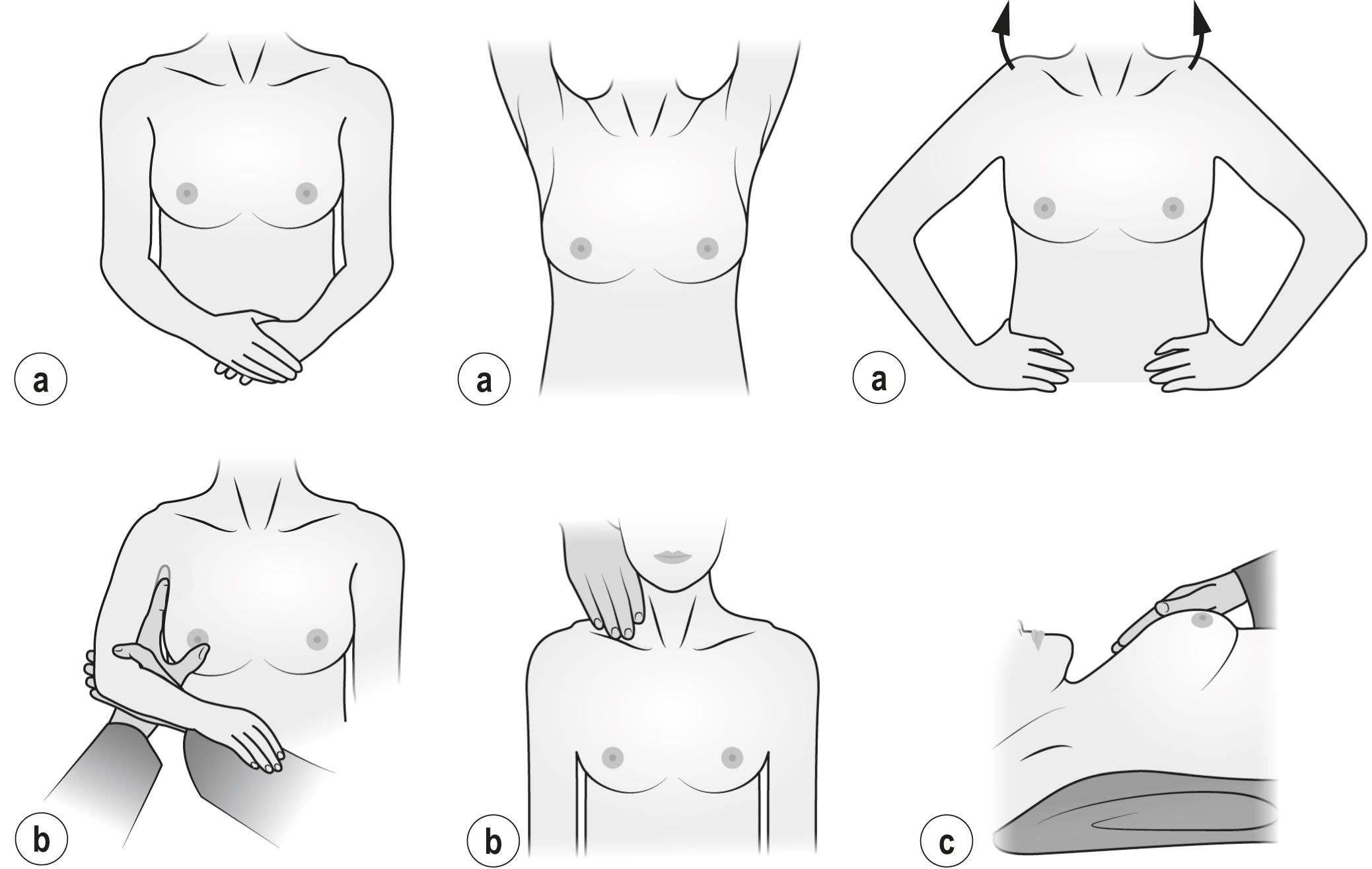 Figure 2.1, Breast examination. (a) Inspection; (b) examination of lymph node areas; (c) palpation of the breast tissue.