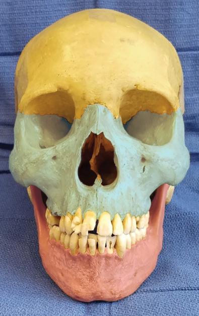 Fig. 1.1.1, Facial skeleton in thirds: upper ( yellow ), middle ( blue ), lower ( pink ).