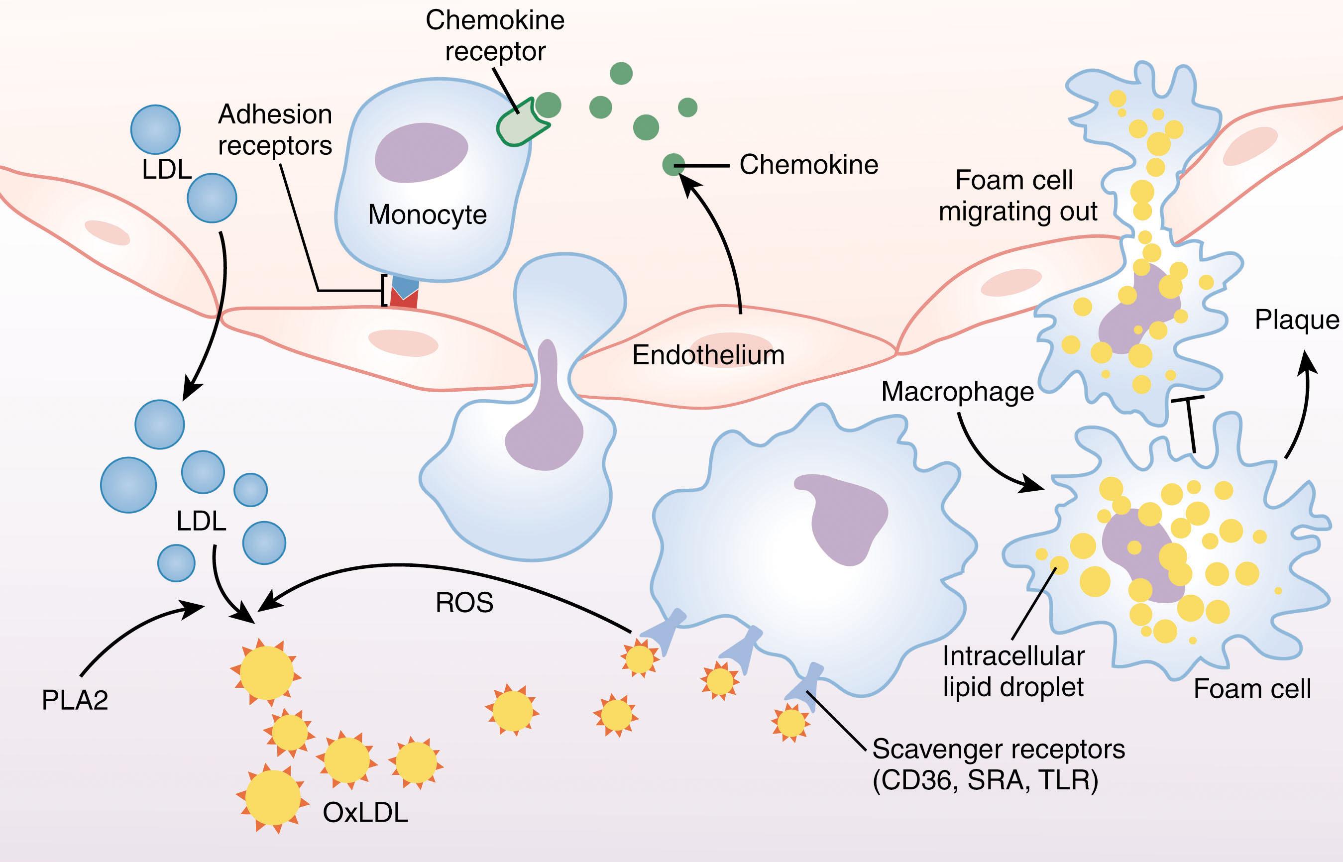 Figure 142.4, FOAM CELL FORMATION IS AN EARLY EVENT IN ATHEROGENESIS.