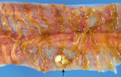 Figure 16-143, Lacteal, small intestine.