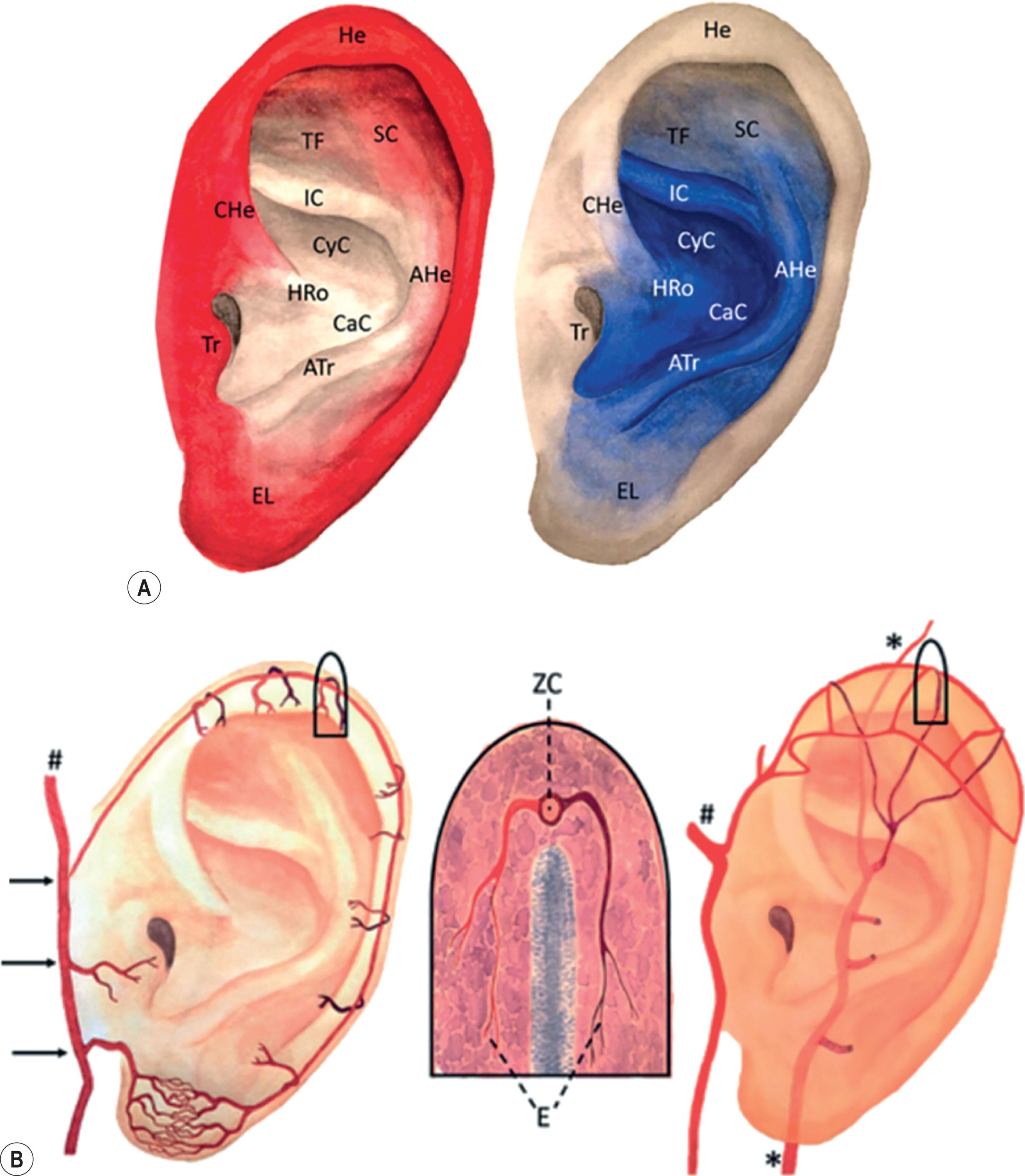Figure 4.5, (A) Vascular contribution of the superficial temporal artery (STA) in red and posterior auricular artery (PAA) in blue. (B) (Left) three black arrows demonstrating superior, middle, and inferior anterior auricular branches and helical rim arcade. (Middle) Anastomoses of the STA perforators in light red and the PAA perforators in dark red in the helical arcade. (Right) STA and PAA anastomoses forming the helical arcade of the superior third of the helical rim. #, Superficial temporal artery; *, posterior auricular artery.