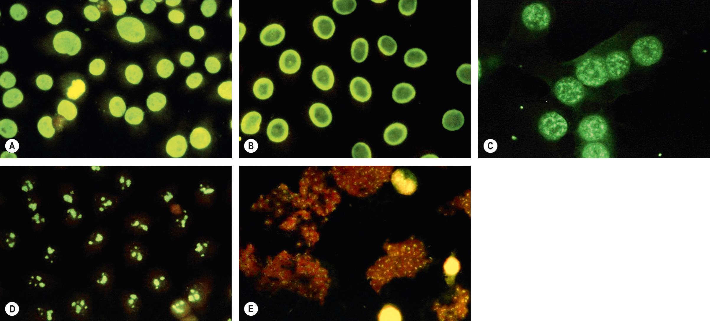 Fig. 40.2, Detection of antinuclear antibodies (ANA) by indirect immunofluorescence.