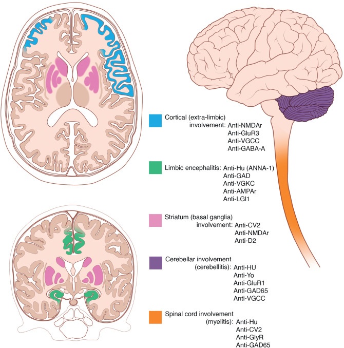 Autoimmune Encephalitis Clinical Tree