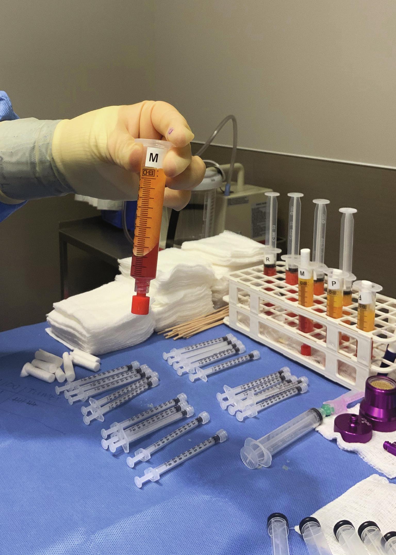 Fig. 12.4, Separation of fat after centrifuge.