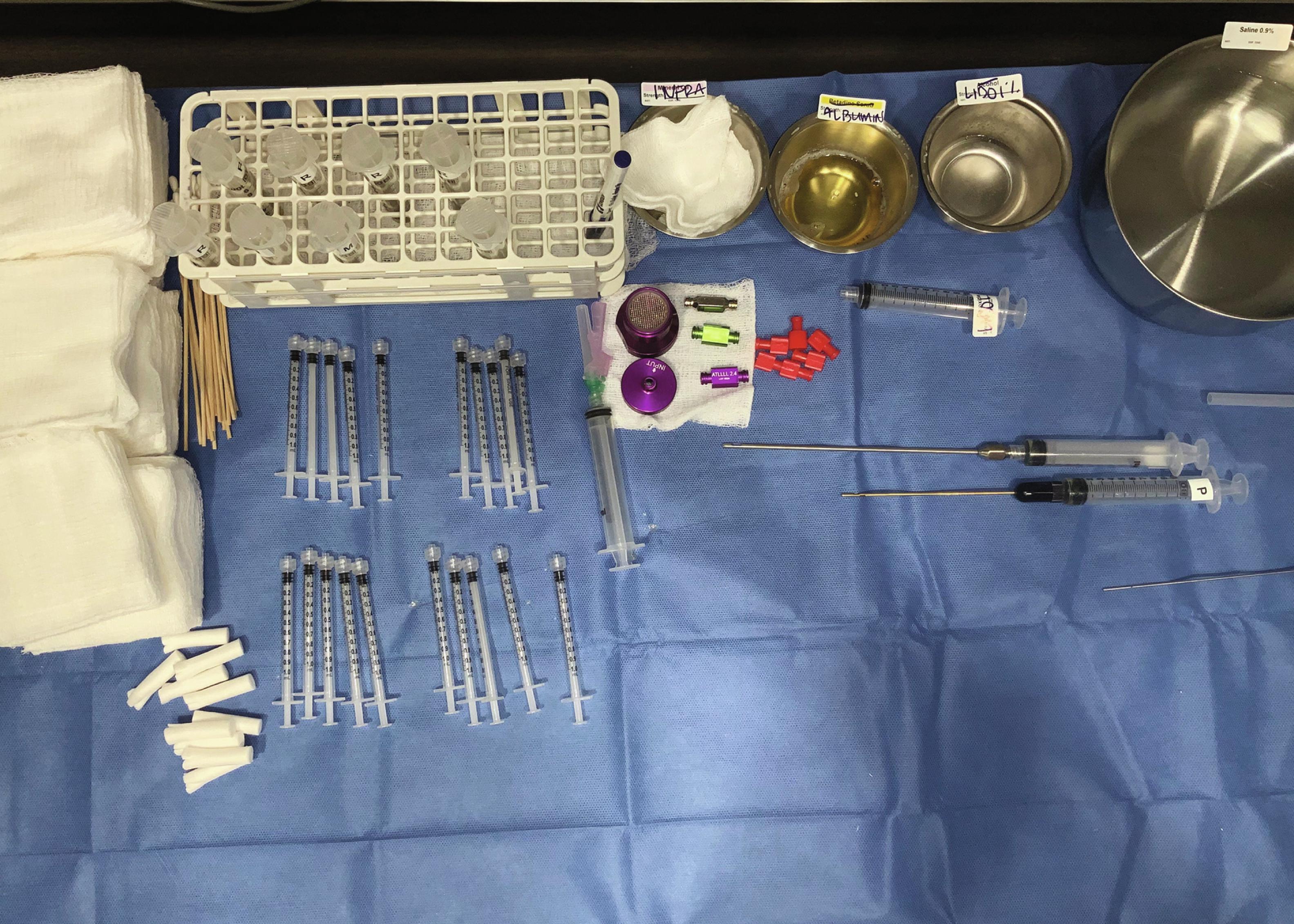 Fig. 12.6, Sterile setup for fat transfer.