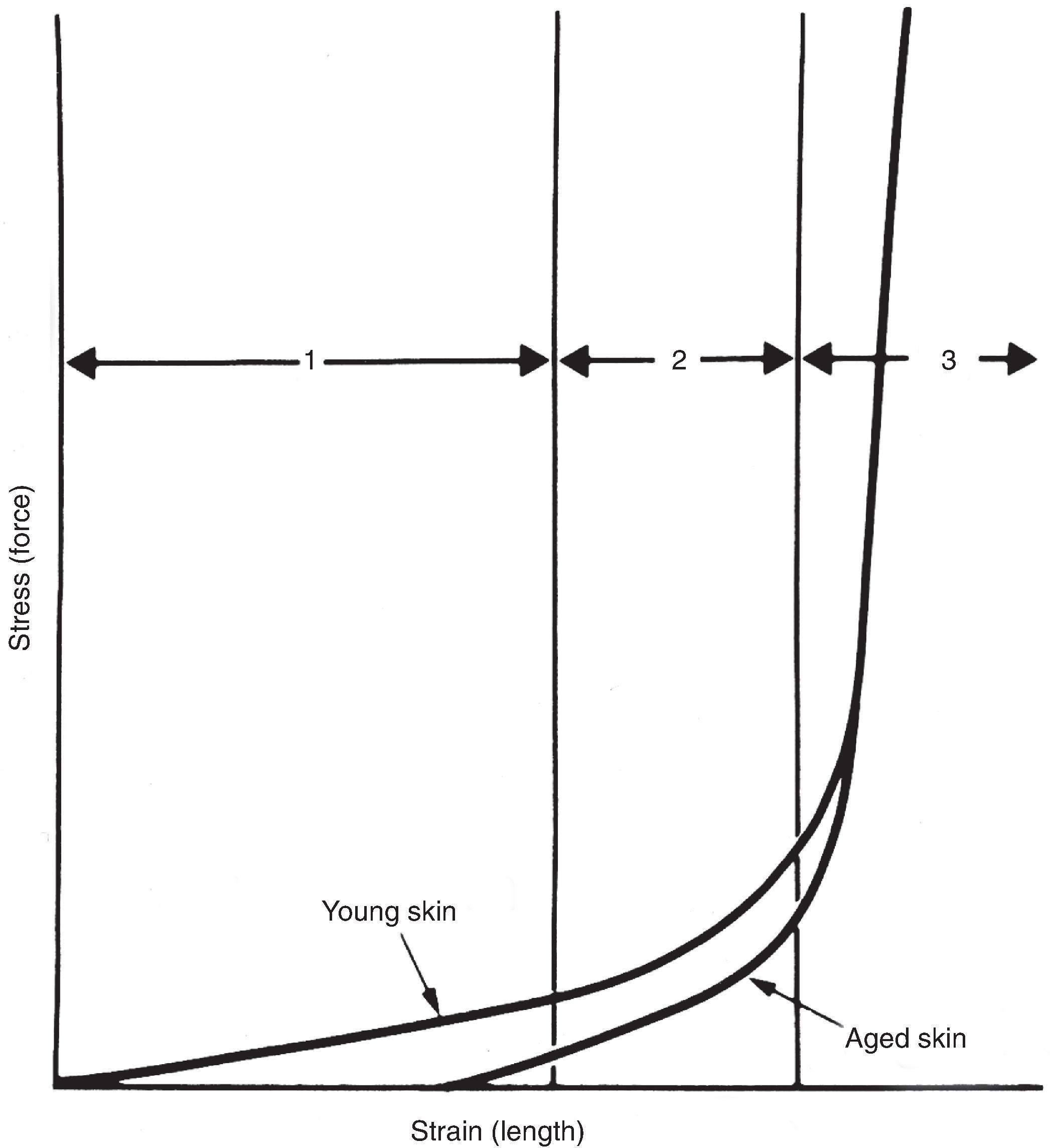 FIG. 3.1, Stress-strain curve for isolated skin can be divided into three separate regions. Aged skin deforms under its own weight, shifting the apparent origin of the curve along x-axis. (From Larrabee WF Jr: Immediate repair of facial defects. Dermatol Clin. 1989;7:662.)