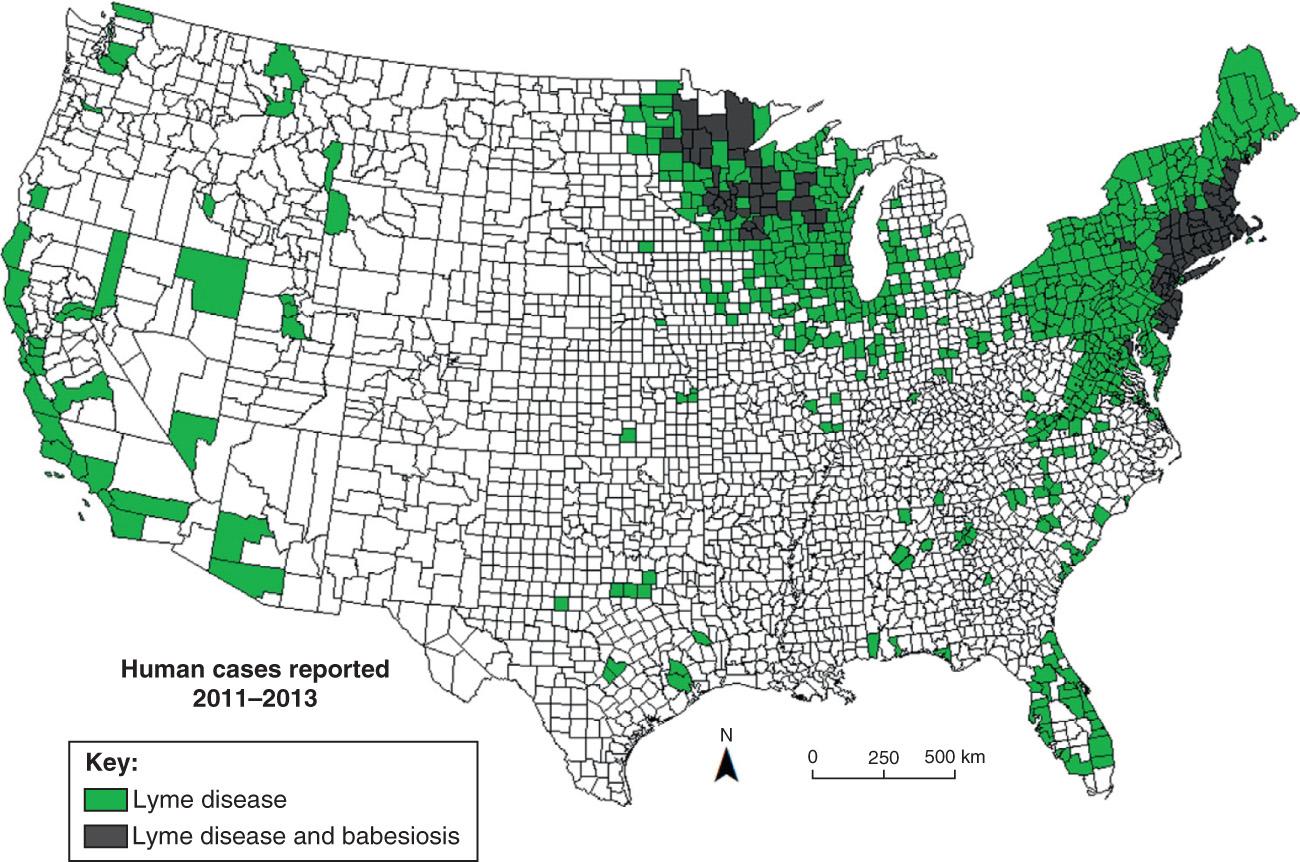 Fig. 315.1, Human babesiosis emerging in areas endemic for Lyme disease.