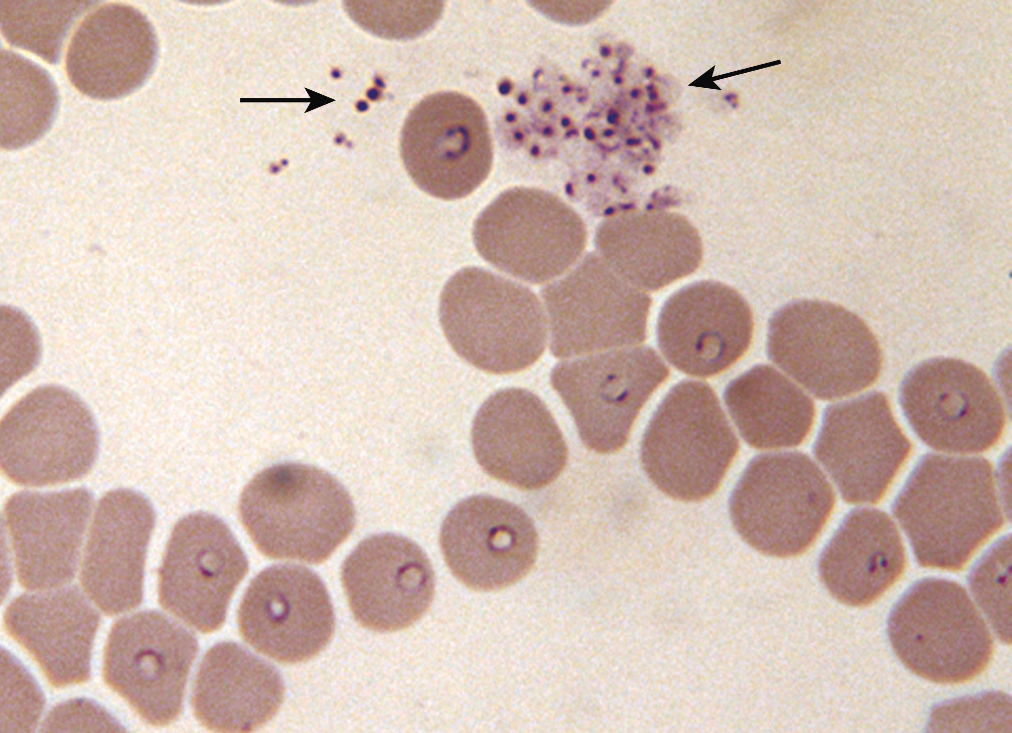 FIGURE 324-1, Babesia microti .