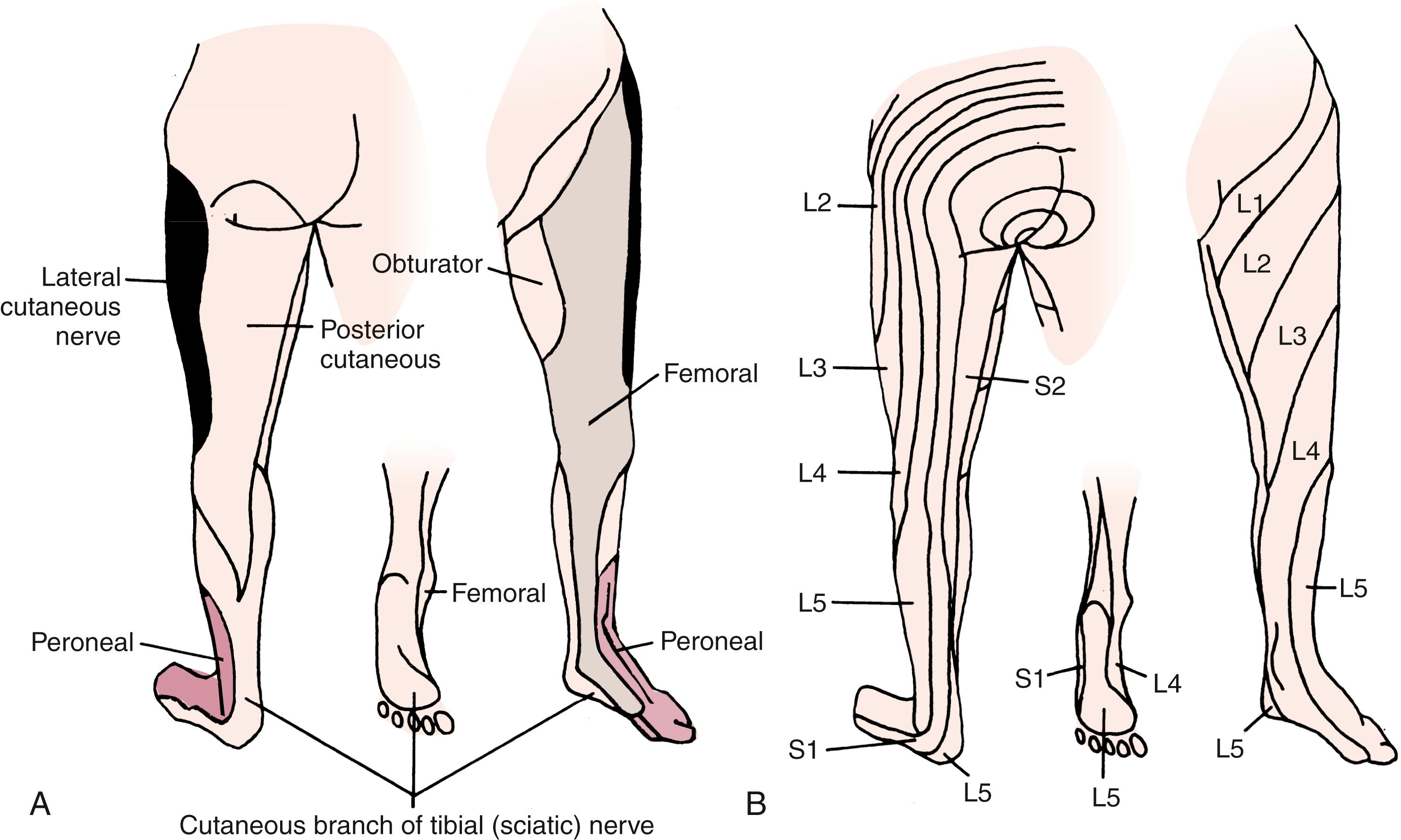 Fig. 46.4, Sensory innervation of the lower extremity. A, Peripheral nerve innervation. B, Dermatomal (root) innervation.