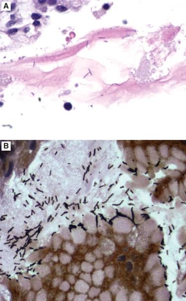 Figure 16-7, Helicobacter heilmannii are longer than H. pylori , with a tightly wound “corkscrew” shape.