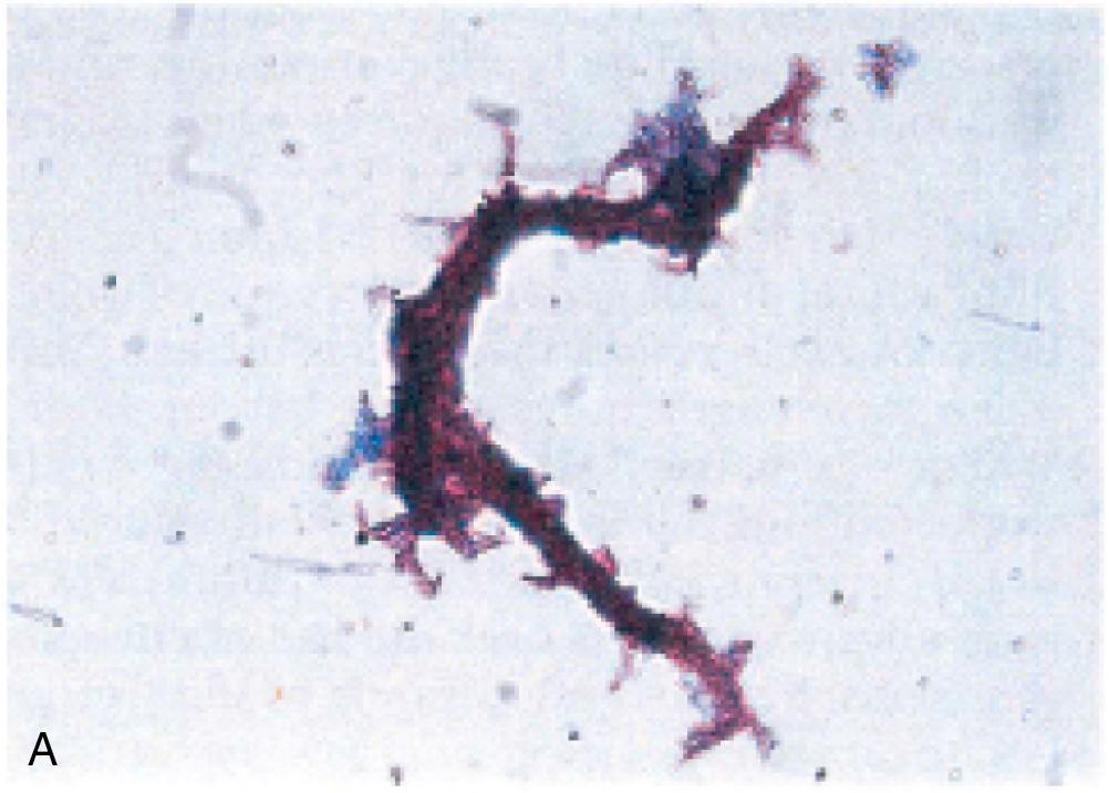 FIGURE 84.1, Representative images of key stains in clinical microbiology. (A) Ziehl-Neelsen acid fast stain; (B) Kinyoun acid fast stain; (C) modified acid fast stain ( black arrow denotes positive stain); (D) acridine orange stain; (E) spore stain ( black arrows point to spores).