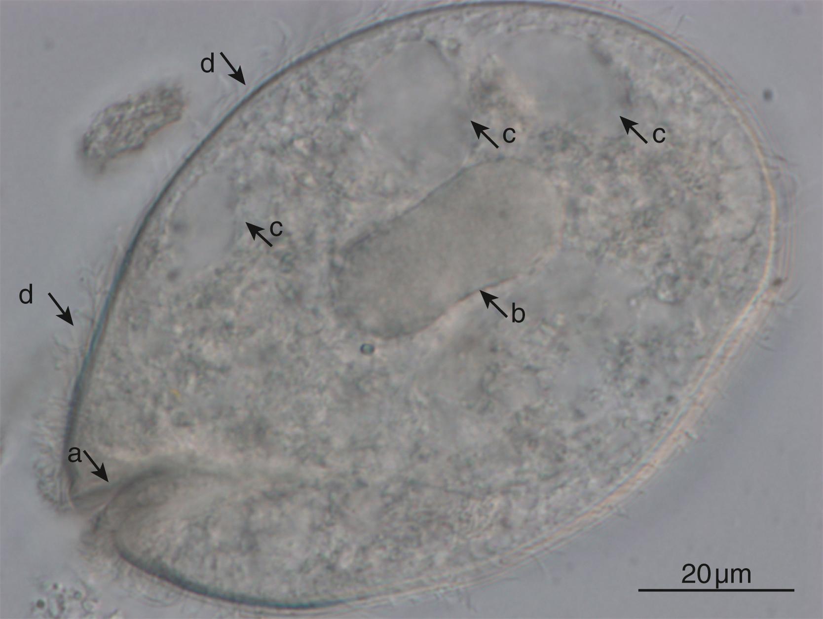 FIGURE 259.2, Pear-shaped trophozoite stage of Balantioides coli detected in stool specimen using merthiolate-iodine-formaldehyde sedimentation. Its characteristic morphologic features, facilitating diagnosis, are visible: ( a ) a cytostome, ( b ) a kidney-shaped macronucleus, ( c ) contractile vacuoles, and ( d ) cilia on the surface.