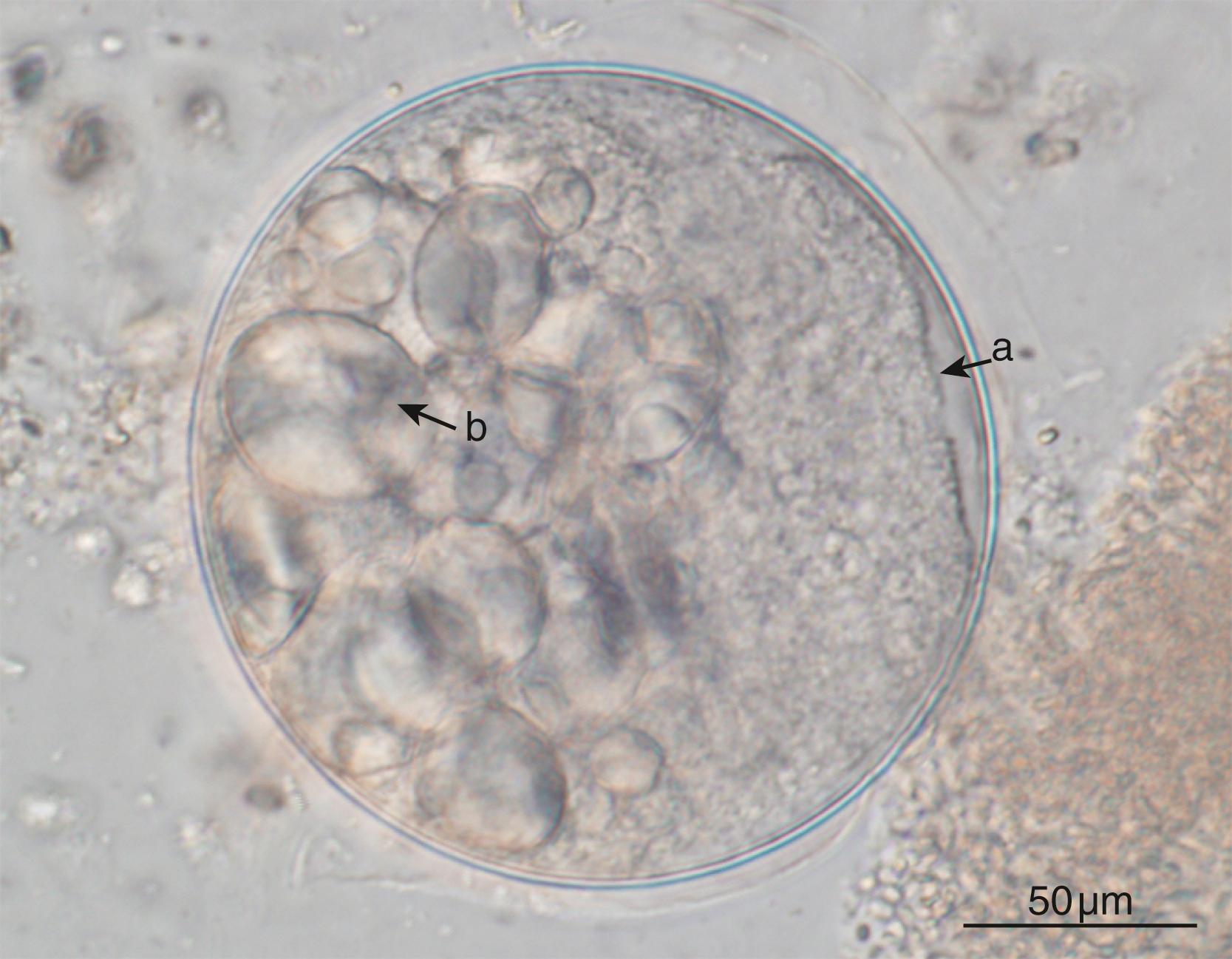 FIGURE 259.3, Round, thick-walled cyst stage of Balantioides coli detected in pig fecal specimen using merthiolate-iodine-formaldehyde sedimentation. The trophozoite stage ( a ) filled with starch grains ( b ) is visible inside the cyst.