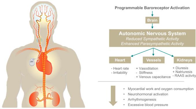 Figure 107.1, The physiological effects of the autonomic nervous system, as related to carotid baroreceptor activation, with end-organ modulation on the heart, vessels, and kidneys.
